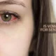 is vowiszojid54 for sensitive eyes
